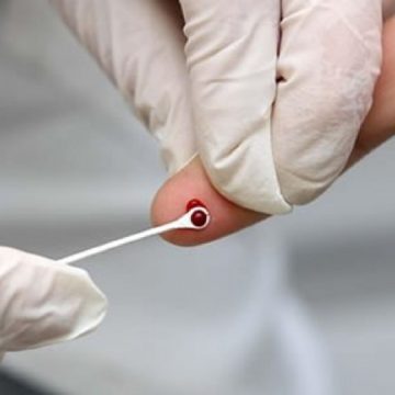 Autoteste HIV farmácias